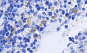 Mouse spleen cells infected with Zika virus. Infected cells are shown in brown, cell nuclei in blue. Image: Courtesy of the Shresta lab at La Jolla Institute for Allergy and Immunology.